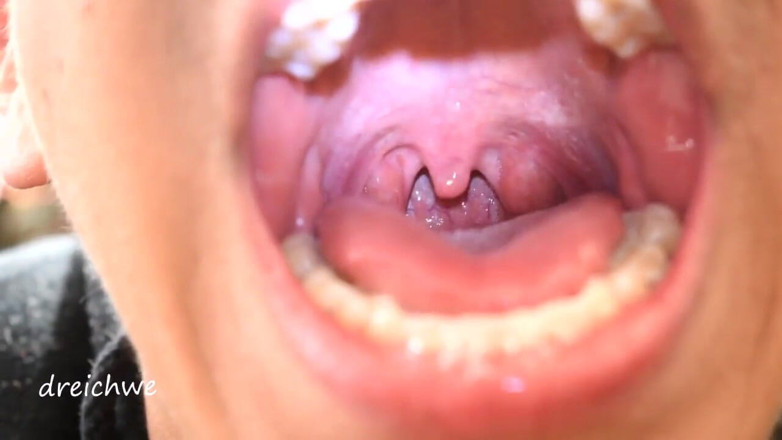 Dreichwe: Uvula fetish mouth