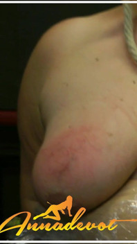 Thick Sagging Tits Spanked with Clear Marks and Sharp Close-ups, Just as a Treatment Makes Me Horny.