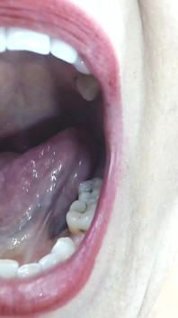 Dentro de mi gran boca, úvula de dientes de lengua
