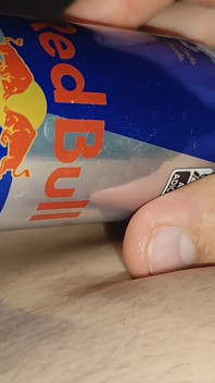 Immense Phimosis in the Can Makes You to the Extreme!