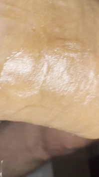 My Penis When I Use My Pump for a Long Time