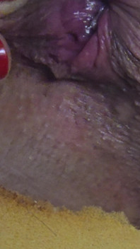 Pushing Out a Creampie