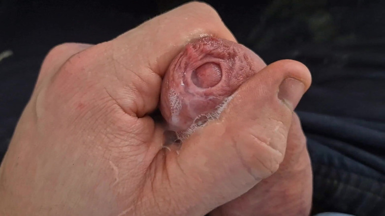 GloomyChase977: Big Uncut Daddy.. Tight Phimosis Foreskin Play, Precum Flood, and...