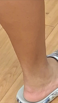 치료로 발을 존경하는 라인에서