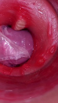 The Camera Inside the Deep Pussy Records a Huge Ejaculation with a Stuck Condom!