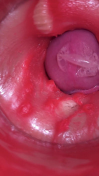 Camera Inside Pussy: Powerfull Cum in Pussy! Best Internal Asmr in 4K More Sperm