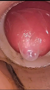 Compilation Di Creampie Gocciolante Di Cumfeti- Vista Endoscopia