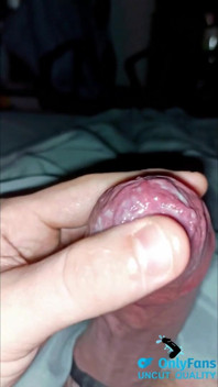 Cum Play with Phimosis Tight Foreskin