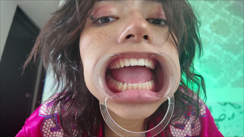 KiyuSweetCrazy: Cheeks Pulled Apart Teeth Exposed