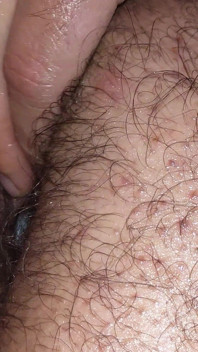 Anal Masturbation