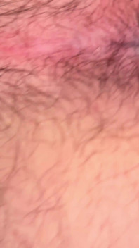 Close up Hairy Hole