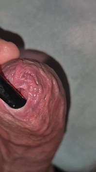 Phimosis Tight Foreskin Wet Play