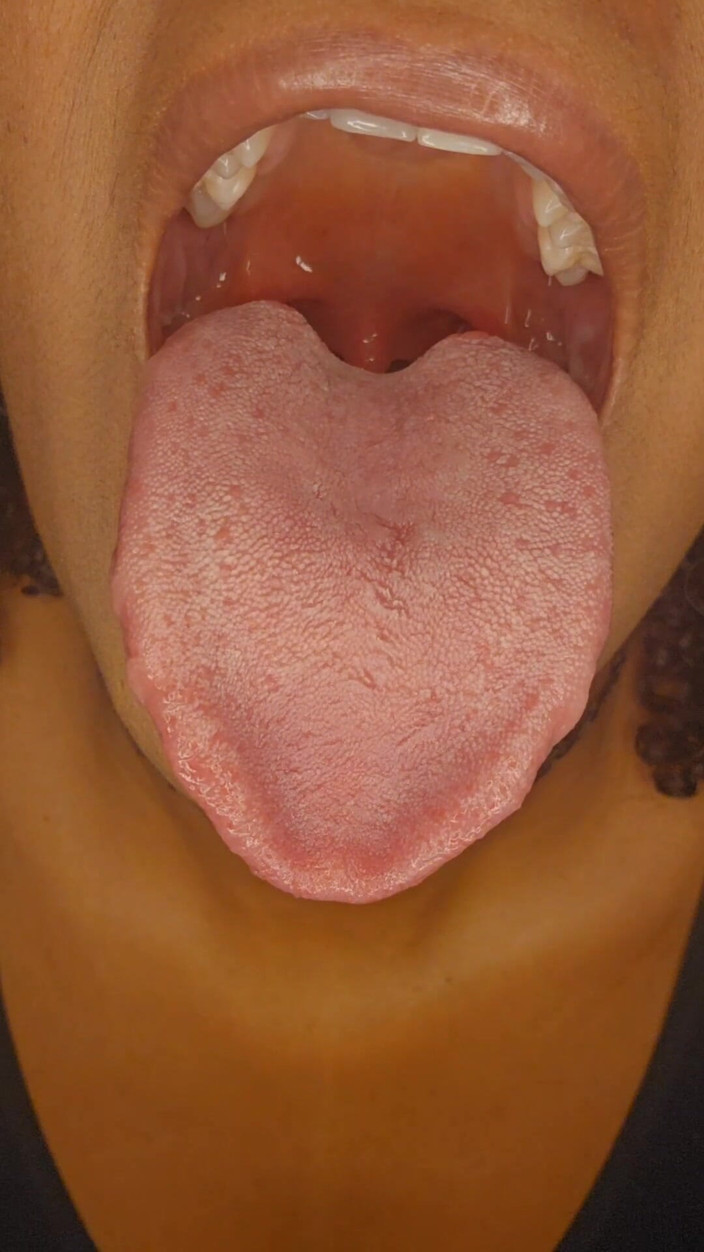 Bunnii: Rozkoš škádlení jazykem