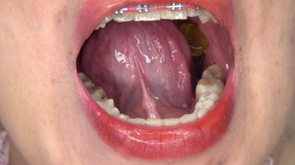 Angel eyes studio: Swallowing Large Gummy Bears, Putting Them in the Vagina