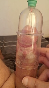 Kontolku di vakum