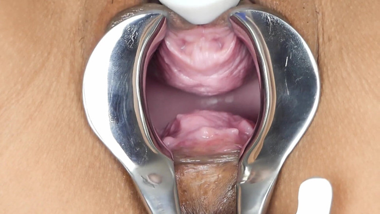 SexyThai1987: Speculum - 私の内側を深く見てください