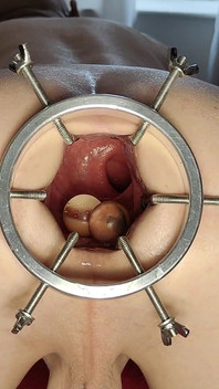 Cât de multe te numeri pentru David Anderson