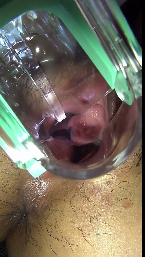Vaginal Observation Video 1