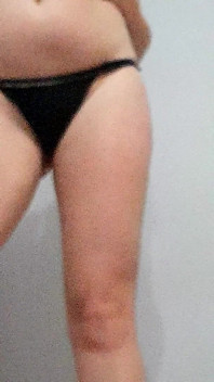 Spogliarello