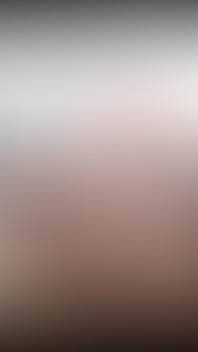 2647219886
