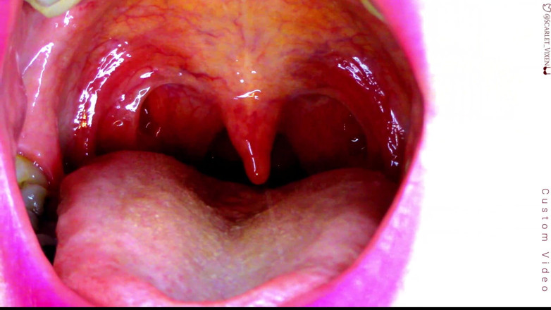 Scarlet Vixen: Sexy scarlet sagt Ahhhh - uvula zeigt