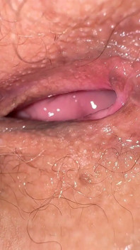 Konstiga trender 18 -årig tjej fick en tatuering av mörk analpigmentation