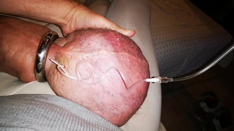 Monster_Meat_: Perverzní naplnění znovu glukózou