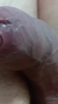 Big Uncut Tight Forskin Cock - Phimosis, Short Cock Play