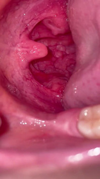 Oral Tour Flash pe deep inside my mouth