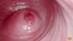 MollyRedWolf: Hej nevlastní bratro! Pojďme si hrát s gynekologem? Gynekologie, endoskopie –...