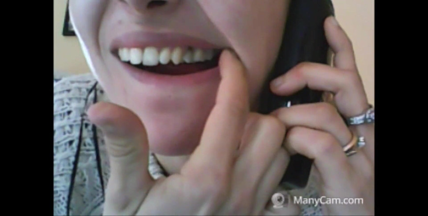 savannahamatoriale: Chantal's Teeth Fall Apart, Rotten and Black