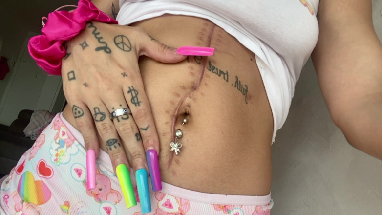 Nali Marie: Scar Fetish Belly Button Waist Tummy Skinny Teen Petite Flat...