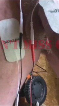 Extraction De Prééjaculation De Bâtard