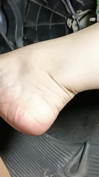 Accelerera och pumpa Corsa-pedaler med flip-flops