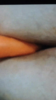 Anal Play