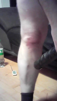 Anal-sesion