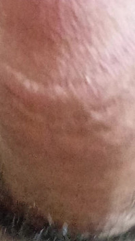 My Dick