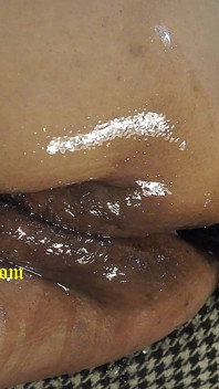 Anal Butt Plug Utbildning