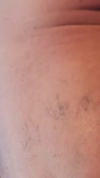Ass Torment for Anal Slut in Bondage