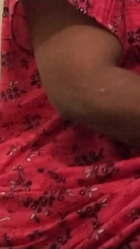 Hot Leg