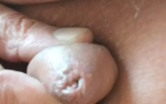 Karlchengeil: Fat Pissing