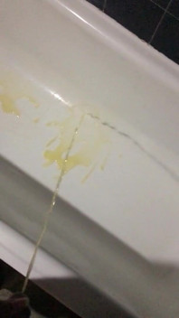 Pipì Nella Vasca Da Bagno