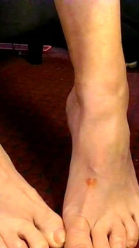 Natural Toe Wiggling