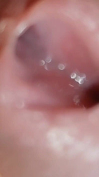Amazing Glans with Two Cum Holes.