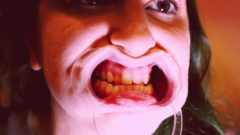 goddessjoules: Mempersiapkan Invisible Aligners