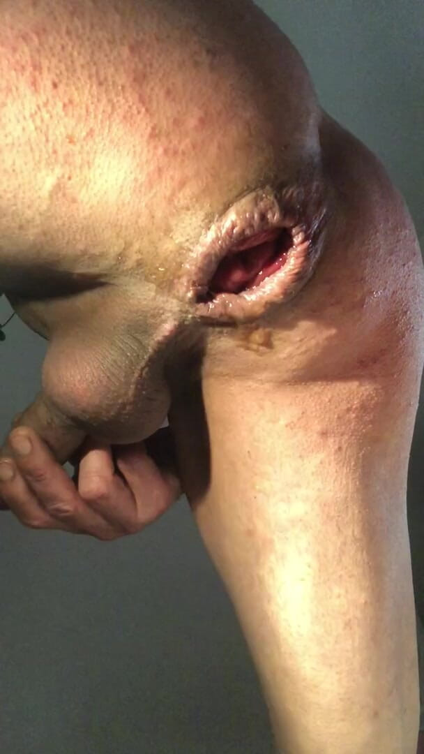 Jardinsecret346: Gape Fisting Anal, Display the Sperm