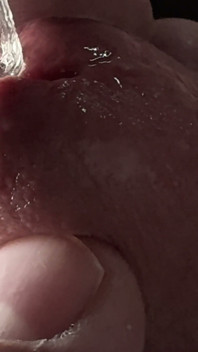 Masturbation