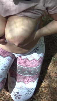 Syrian Refugee Sex in Park