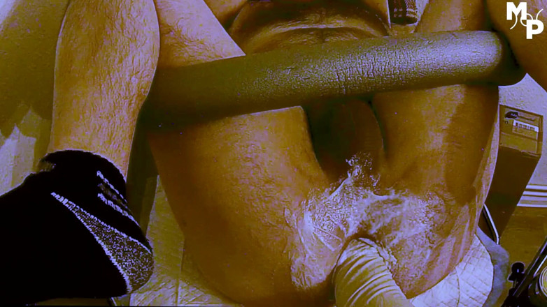 Marcus Pollack Gay: Stretched with two hands and one rubber fist