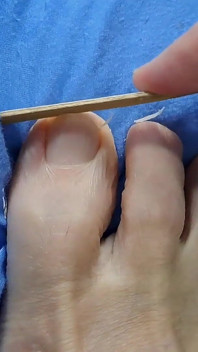 Menjaga Kaki Kecil Dan Kuku Yoga Kaki Bersilang